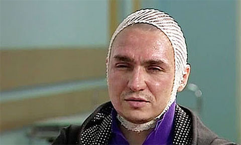 Сергей Филин после покушения